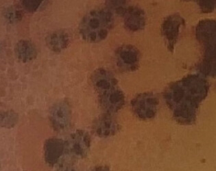 cultivo bacteriano